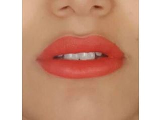 Filler labbra