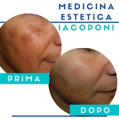Macchie della pelle - Dott. Fabio Iacoponi