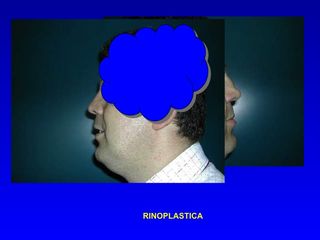 Prof Antonio Montone