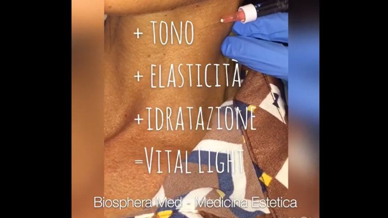 Ringiovanimento collo - Studio medico BiospheraMed