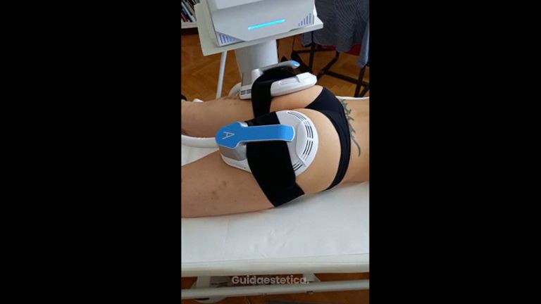Radiofrequenza - Dott.ssa Enrica Mari